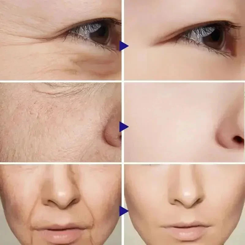 Retinol Anti-Wrinkle Facial Kit — Firming, Brightening & Skin Renewal