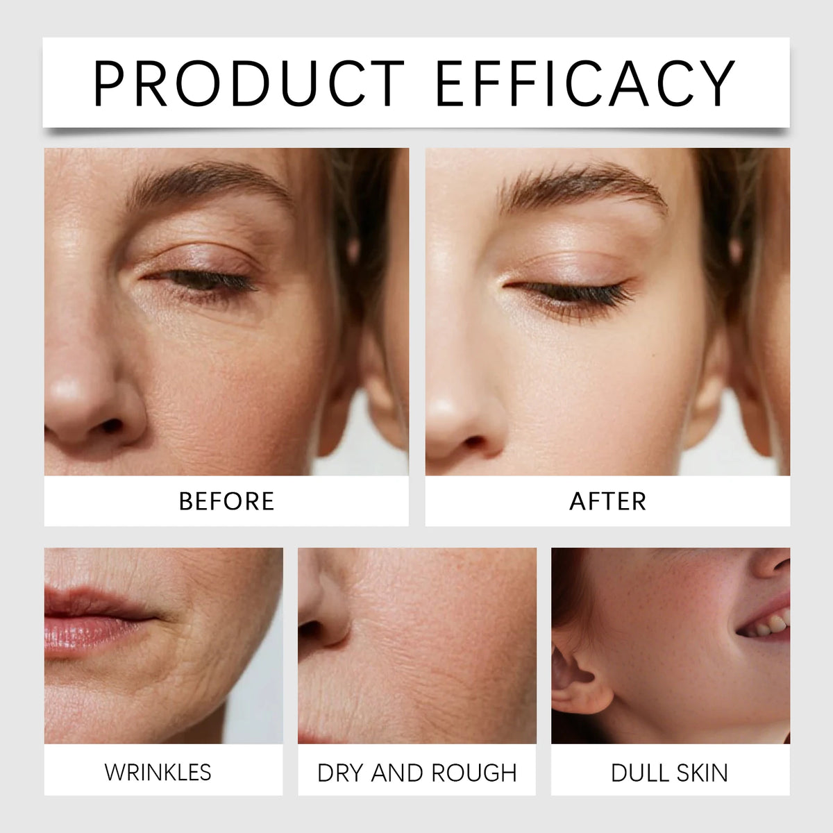 Facial Serum with 0.25mm Microneedles — Deep Hydration and Barrier Repair