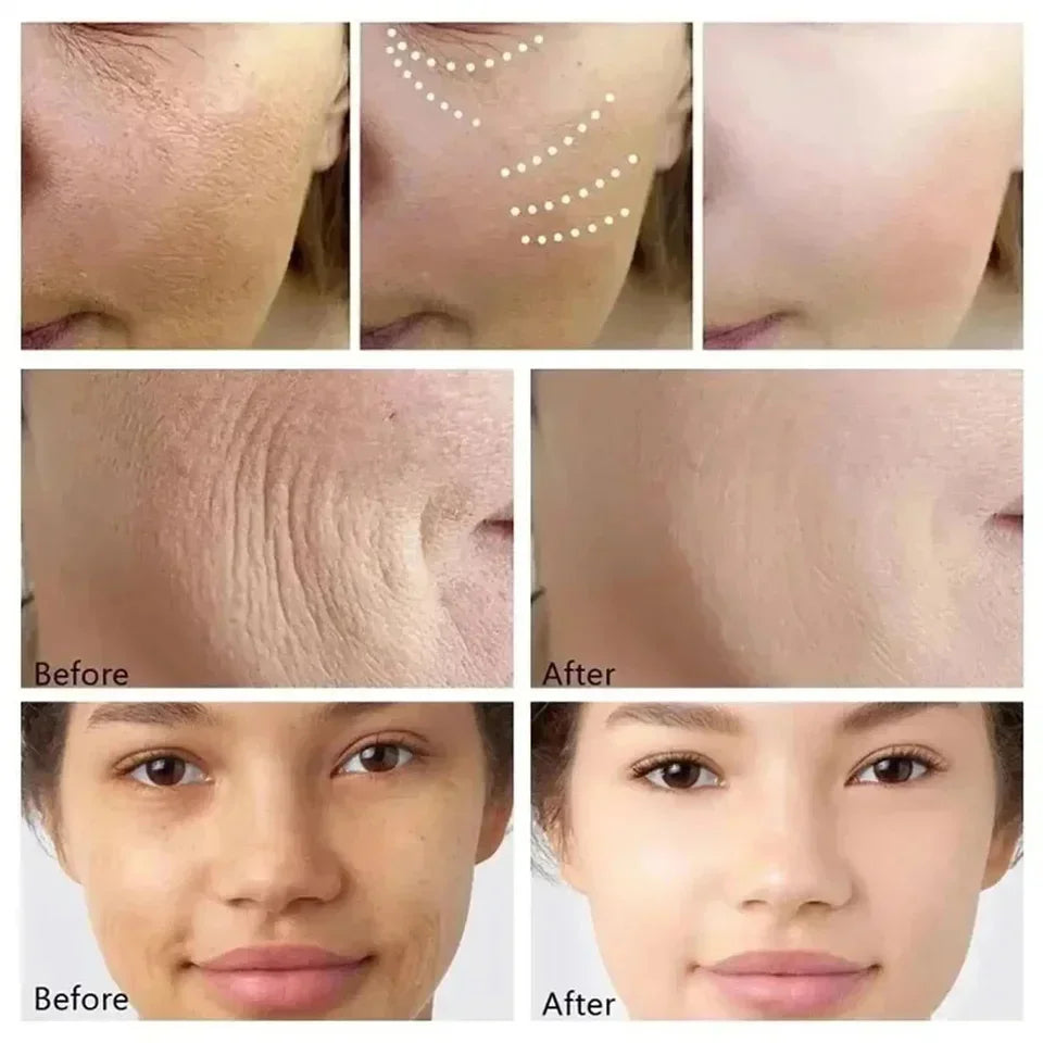 Retinol Anti-Wrinkle Facial Kit — Firming, Brightening & Skin Renewal