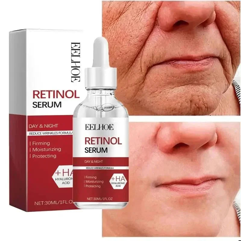 Retinol Anti-Wrinkle Facial Kit — Firming, Brightening & Skin Renewal