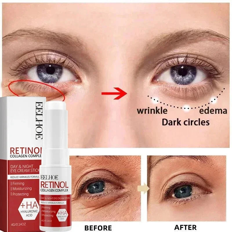 Retinol Anti-Wrinkle Facial Kit — Firming, Brightening & Skin Renewal